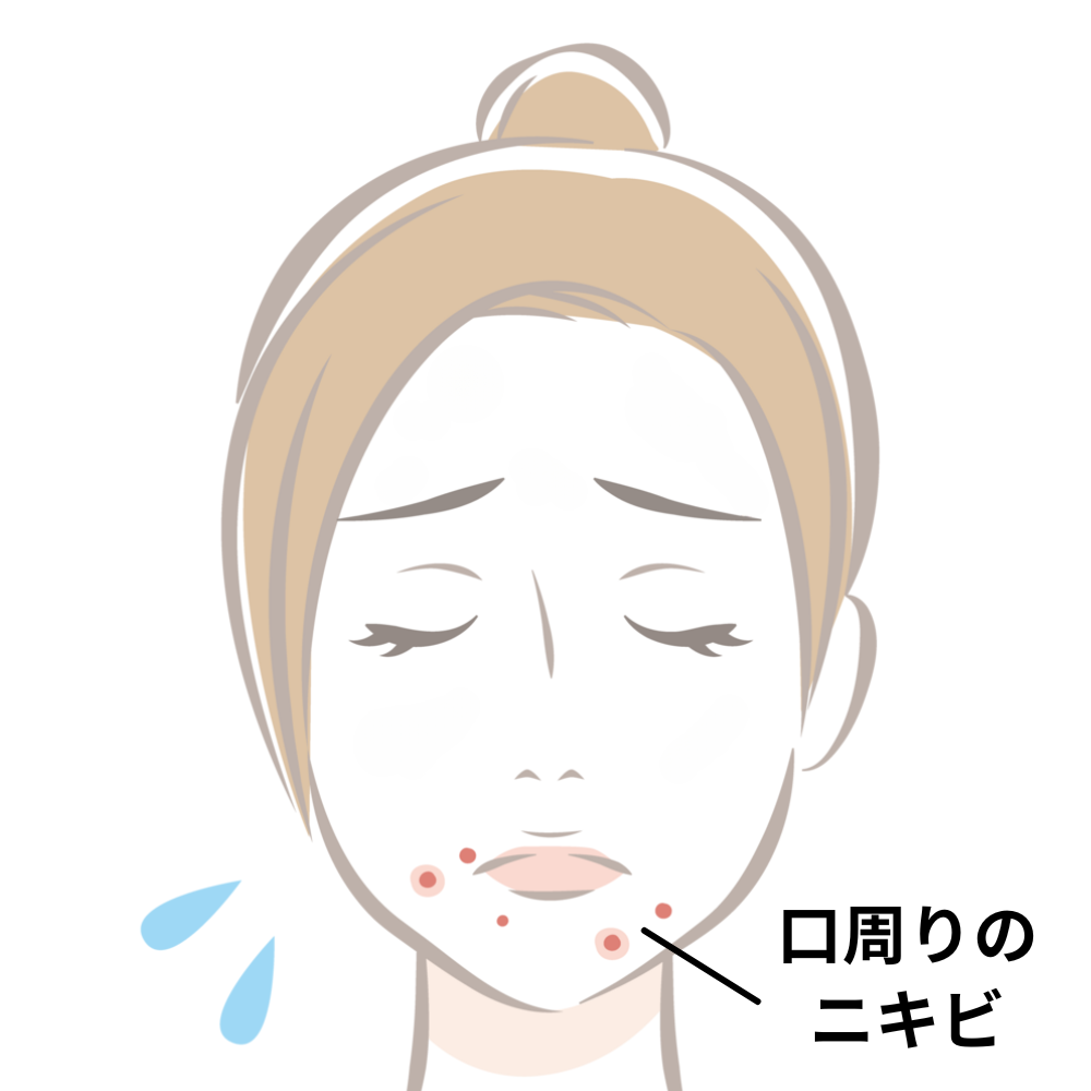 口周りのニキビも噛み合わせが原因かも